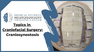 Topics in Craniofacial Surgery Craniosynostosis [upl. by Ardnalak347]