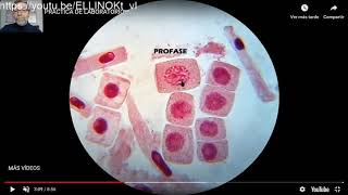 MItosis y citocinesis V35 [upl. by Ralleigh288]