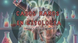 Casos raros en citología 3 Microfilarias [upl. by Elohcin536]