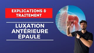 La luxation d’épaule  Si difficile à rééduquer   Explications et traitement [upl. by Cinemod]