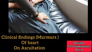 Additional heart sounds on Ascultation of Heart  Murmurs  CVS examination Part 4 [upl. by Phenica]