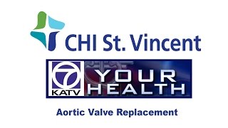 KATV Dr F Michael Bauer Discusses Aortic Valve Replacement [upl. by Oruntha]