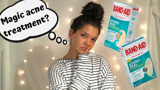 Do HydroSeal Bandages Really Help With Acne [upl. by Hassin]