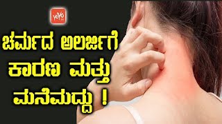 ಚರ್ಮದ ಅಲರ್ಜಿಗೆ ಕಾರಣ ಮತ್ತು ಮನೆಮದ್ದು   Skin Allergy Remedies in Kannada  YOYO TV Kannada Health [upl. by Noiraa623]