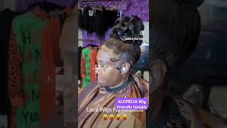 Hair Loss Solutions for Traction Alopecia wigs hairstylist alopecia hairextensions hair [upl. by Roux276]