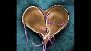 Infectious Disease InfoVid  Giardia [upl. by Knitter]