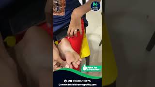 Foot Corn Treatment Success Patients Testimonial with Dr Hrishikesh Bhujbal [upl. by Jarus]