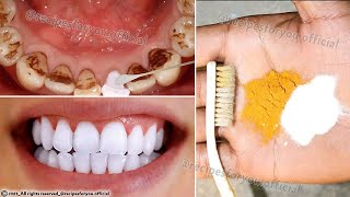 Secret that Dentists dont want you to know Remove Tartar and Teeth Whitening in just 2 minutes [upl. by Aelam]