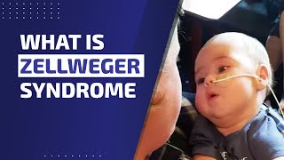 WHAT IS ZELLWEGER SYNDROME [upl. by Orimar]