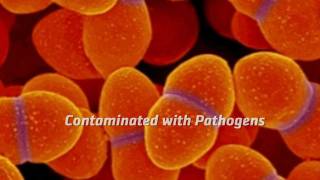 BIOLASE WaterLase vs Cross Contamination [upl. by Aretahs481]