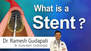 Hi9  What is a Stent  DrRamesh Gudapati  Cardiologist [upl. by Allecsirp]