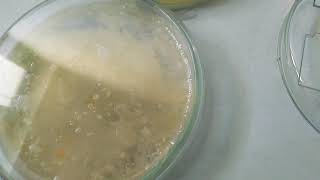 Catalase test for bacteria  Microbiology practical [upl. by Bram]