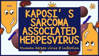 Kaposi Sarcoma Associated Herpes virus HHV 8 Morphology Diagnosis Treatment amp Prevention [upl. by Ainecey]