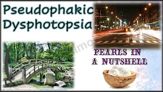 Pseudophakic Dysphotopsia │Pearls in a Nutshell 4 [upl. by Adirf]