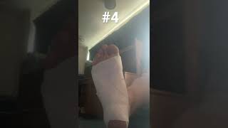 Taping your foot when you have Plantars Fasciitis Running [upl. by Kaete]