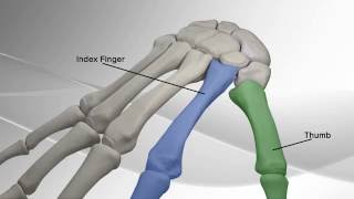 Thumb Metacarpal Arthritis Repair with Arthrex® CMC Mini TightRope® [upl. by Mazman]