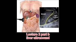 Abdominal ultrasound course  lecture 2 part b  liver د عمرو صلاح [upl. by Oneil]