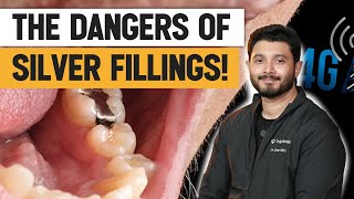 The Dangers Of Silver Fillings  Dr Jibran [upl. by Menendez]