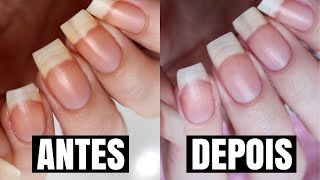 COMO TIRAR O AMARELO DAS UNHAS [upl. by Ardnoid]