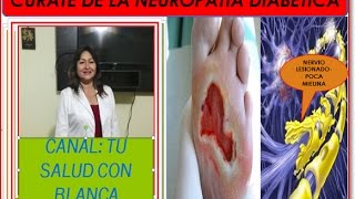 CURATE DE LA NEUROPATIA DIABÉTICA1era parte [upl. by Otrebtuc]