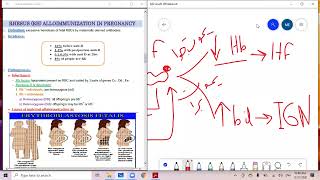 د السكري erythroblastosis fetalis rh [upl. by Pirali]