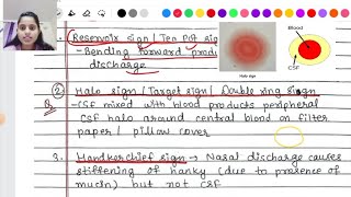 CSF rhinorrhea  causes symptoms Signs diagnosis treatment [upl. by Lairbag]