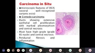 morphological types of breast cancer [upl. by Yaresed]