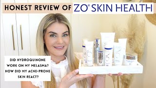 ZO Skincare Review Hydroquinone for Melasma did it work [upl. by Edelson596]