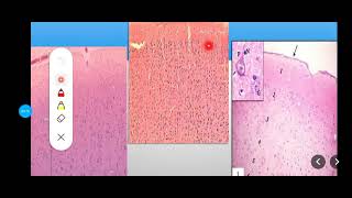 Histology Slides Series Episode 17  Histology of Nervous Tissues including Peripheral Nerves [upl. by Atonsah]