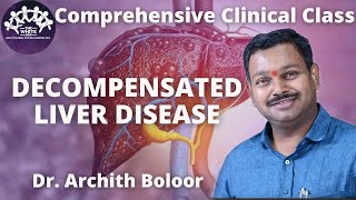 DECOMPENSATED LIVER DISEASE clinical case presentation [upl. by Zobkiw266]