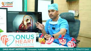 Revolutionizing Heart Valve Care Dr Lakkireddy on Advanced TAVI Procedure at Onus Heart Institute [upl. by Ahsemak]