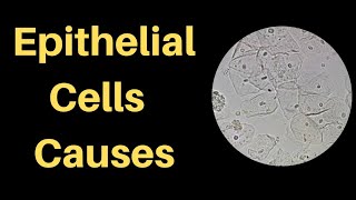 Epithelial Cells in Urine  CausesTypesNormal Range [upl. by Oicaroh]