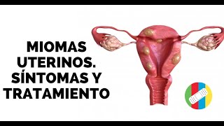 MIOMAS UTERINOS Síntomas y Tratamiento [upl. by Kelli823]