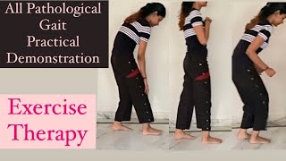 All Pathological Gait demonstration Exercise Therapy [upl. by Peursem983]