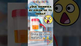 ¿Qué significa el color de la orina 😱⚠️ Parte 1 shortvideo [upl. by Yorick]