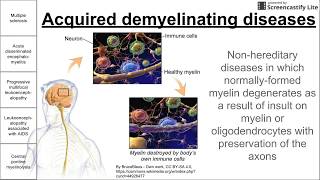 Acquired demyelinating diseases [upl. by Quintilla]