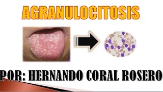 AGRANULOCITOSIS  INSUFICIENCIA DE NEUTROFILOS [upl. by Ainirtac]