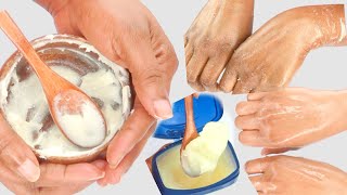 HOW TO EASILY GET SOFT HEALTHY HANDS AT HOME WRINKLEFREE SMOOTH HANDS [upl. by Hildy]