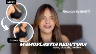 TUDO SOBRE MINHA MAMOPLASTIA REDUTORA COM VÍDEO DE ANTES E DEPOIS [upl. by Legna]