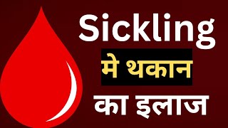 Sickling मे थकान का इलाज।Sickle cell anemia [upl. by Adkins]