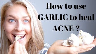 6 Garlic Benefits for Acne How to Use Garlic to Heal Acne Topically amp Internally [upl. by Ikkim]