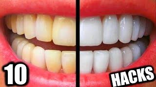 10 Simple Life Hacks For Teeth Whitening Everyone Should Know DIY Teeth Whitening Hacks [upl. by Reywas]