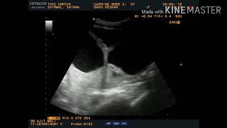 How to Diagnose Hydrometra Mucometra in Goats [upl. by Terej]