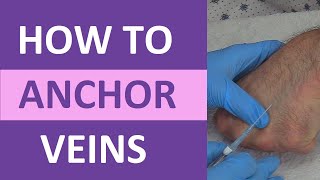 How to Anchor Veins  Venipuncture IV Therapy Blood Draw Phlebotomy Rolling Veins [upl. by Ecyt]