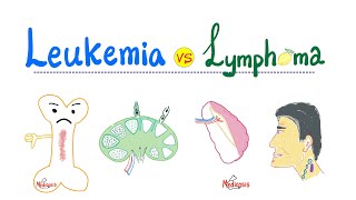 Leukemia amp Lymphoma Introduction  Distinctions in Oncology  Hematology Series [upl. by Sibyls867]