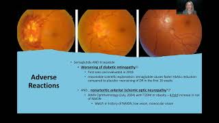 Incretin Mimetrics  Ozempic Wegovy and Mouraro  For Metabolic Disease  Diabetes  For Eye Care [upl. by Sahc391]