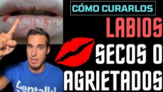 Cómo curar los LABIOS ROTOS SECOS QUEMADOS o AGRIETADOS  Remedios caseros [upl. by Eamaj424]