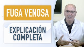 FUGA VENOSA Explicación diagnóstico tratamiento y nuevos avances [upl. by Ettenahs]