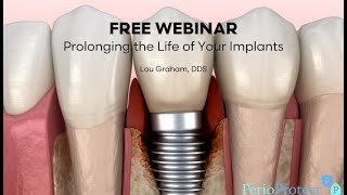 Dental Treatment Prolong the Life of Your Implants Sep 28 2021 [upl. by Ehrlich]