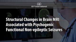 Structural Changes in Brain MRI Associated with Psychogenic Functional Nonepileptic Seizures [upl. by Ttevy193]